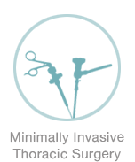 Minimally Invasive Thoracic Surgery - Michael Harden Cardiothoracic Surgeon