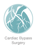 Cardiac Bypass Surgery - Michael Harden Cardiothoracic Surgeon